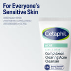 Cetaphil Gentle Clear BPO Acne Face Wash, Soothing, Sensitive Skin, 4.2 fl oz