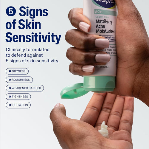 Cetaphil Gentle Clear Mattifying Acne Face Moisturizer, Salicylic Acid, 3oz | Salicylic Acid Moisturizer, Non-Comedogenic, Hydrates Sensitive Acne-Prone Skin, Oil Control, Gentle Skincare, 3 oz