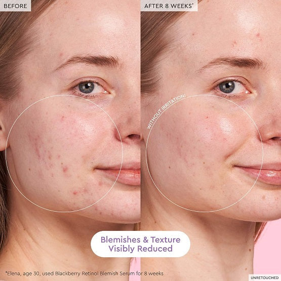 Glow Recipe - Blackberry Retinol Blemish Serum - 30ML - Image 4