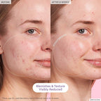 Glow Recipe - Blackberry Retinol Blemish Serum - 30ML - Image 4
