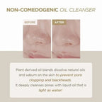 SKIN 1004 MADAGASCAR - Centella Double Cleansing Duo - Image 3