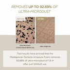 SKIN 1004 MADAGASCAR - Centella Double Cleansing Duo - Image 4