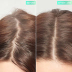 THE INKEY LIST - Glycolic Acid Exfoliating Scalp Scrub - 150ML - Image 3