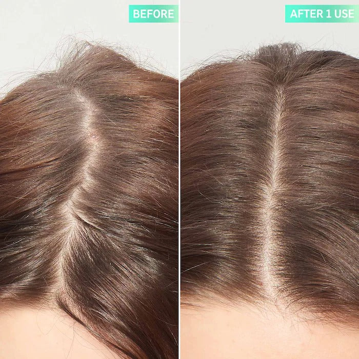 THE INKEY LIST - Glycolic Acid Exfoliating Scalp Scrub - 150ML - Image 3