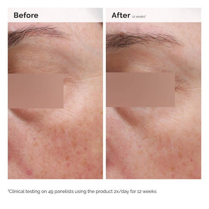 THE ORDINARY - Niacinamide 5% Face and Body Emulsion - 100ML - Image 2