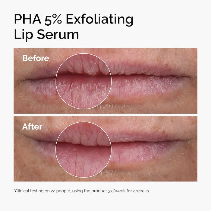 THE ORDINARY - PHA 5% Exfoliating Lip Serum - 15ML - Image 3