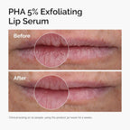 THE ORDINARY - PHA 5% Exfoliating Lip Serum - 15ML - Image 3