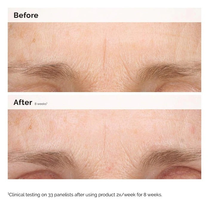 THE ORDINARY - Retinal 0.2% Emulsion High-Strength Retinoid Nighttime Treatment - 15ML - Image 2