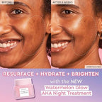 GLOW RECIPE - Watermelon Glow AHA Night Treatment - 60ml - Image 2