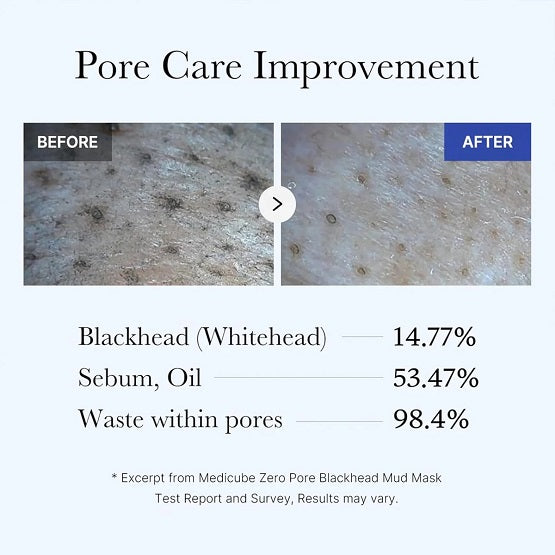 MEDICUBE - Zero Pore Blackhead Mud Mask - 100G - Image 5