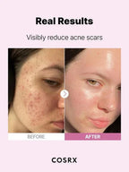 COSRX - The Niacinamide 15 Serum - 20ml - Image 3