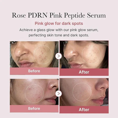 Medicube - PDRN Pink Peptide Serum - 30ml - Image 2