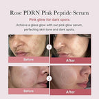 Medicube - PDRN Pink Peptide Serum - 30ml - Image 2