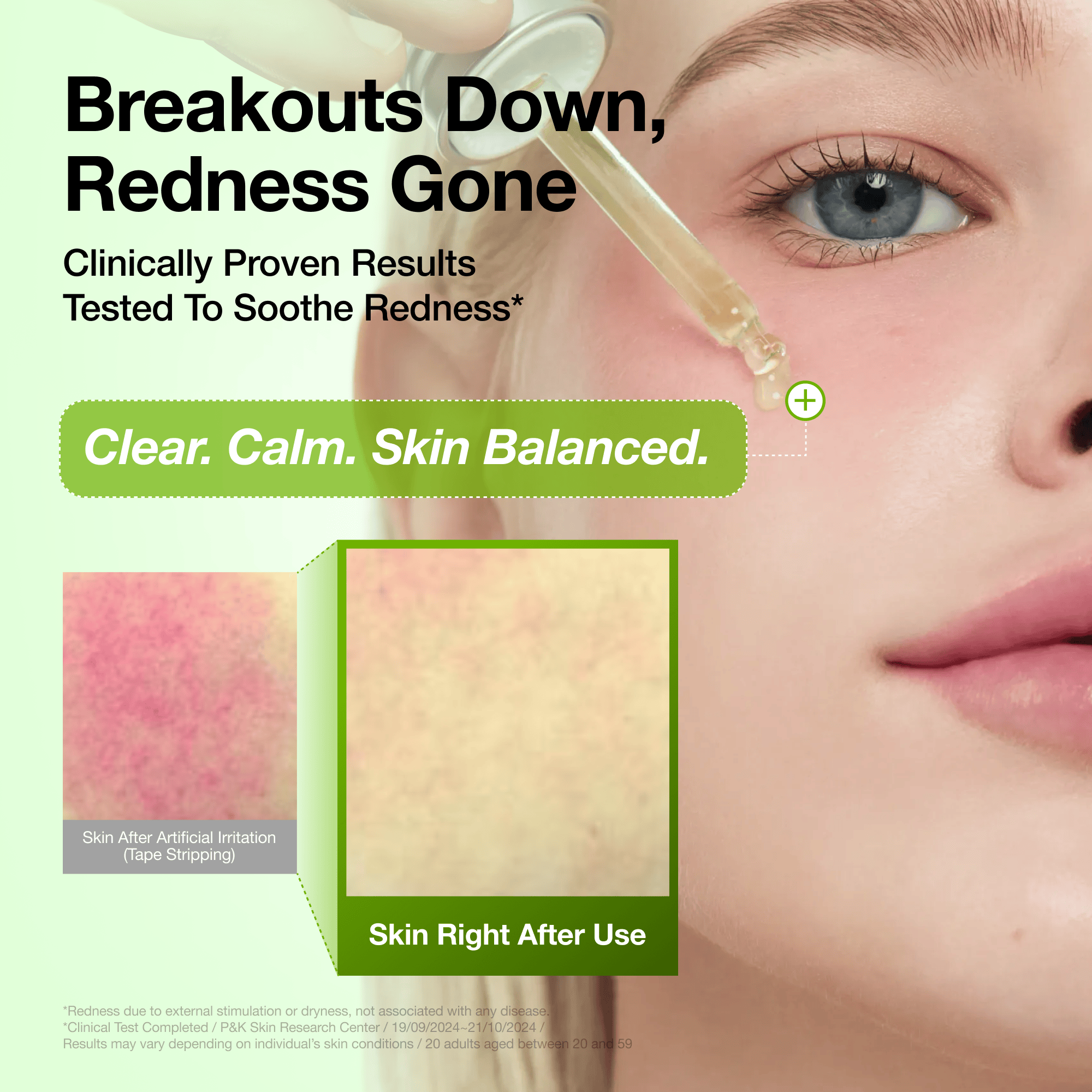 Azelaic Acid 10 Hyaluron Redness Soothing Serum - Image 5