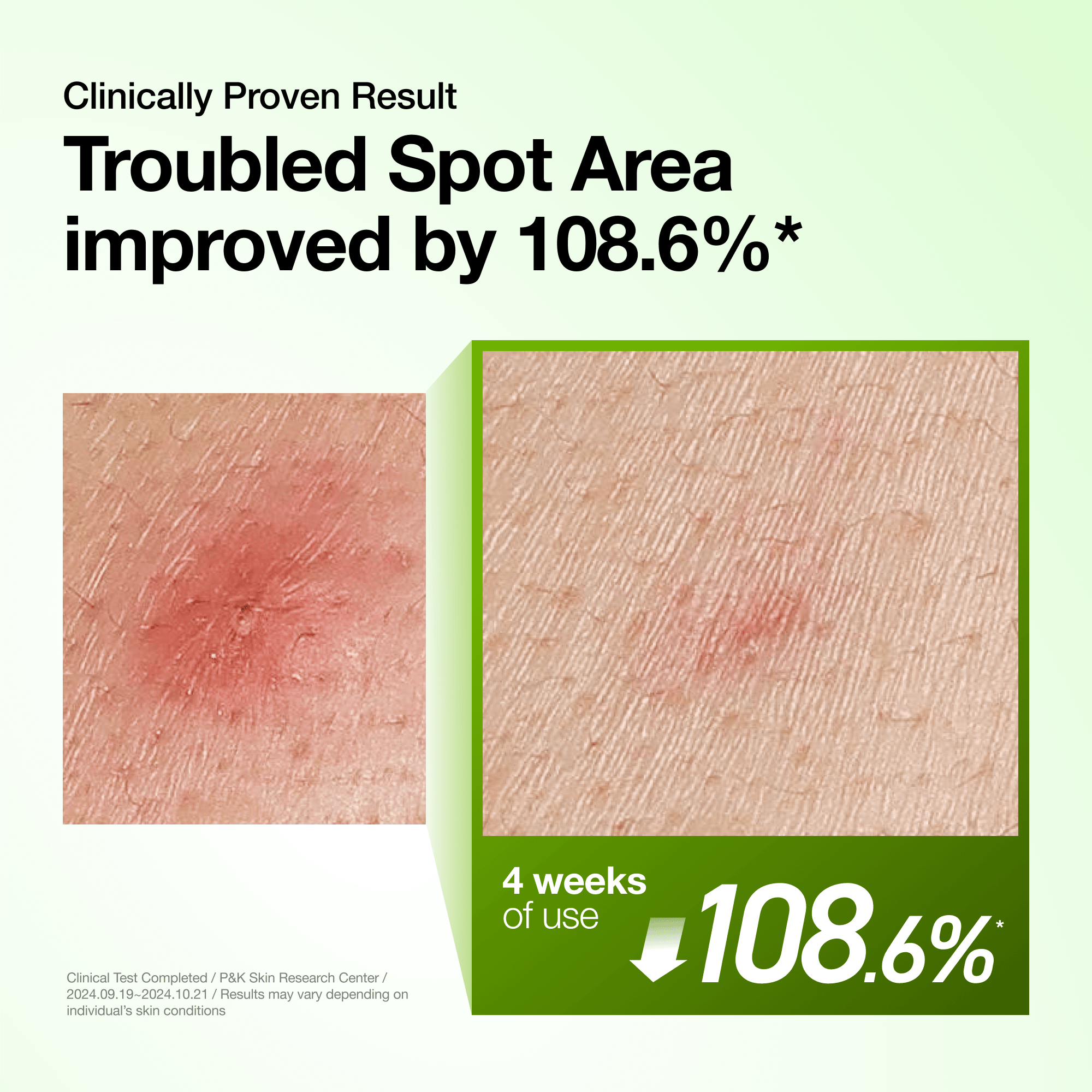 Azelaic Acid 10 Hyaluron Redness Soothing Serum - Image 4