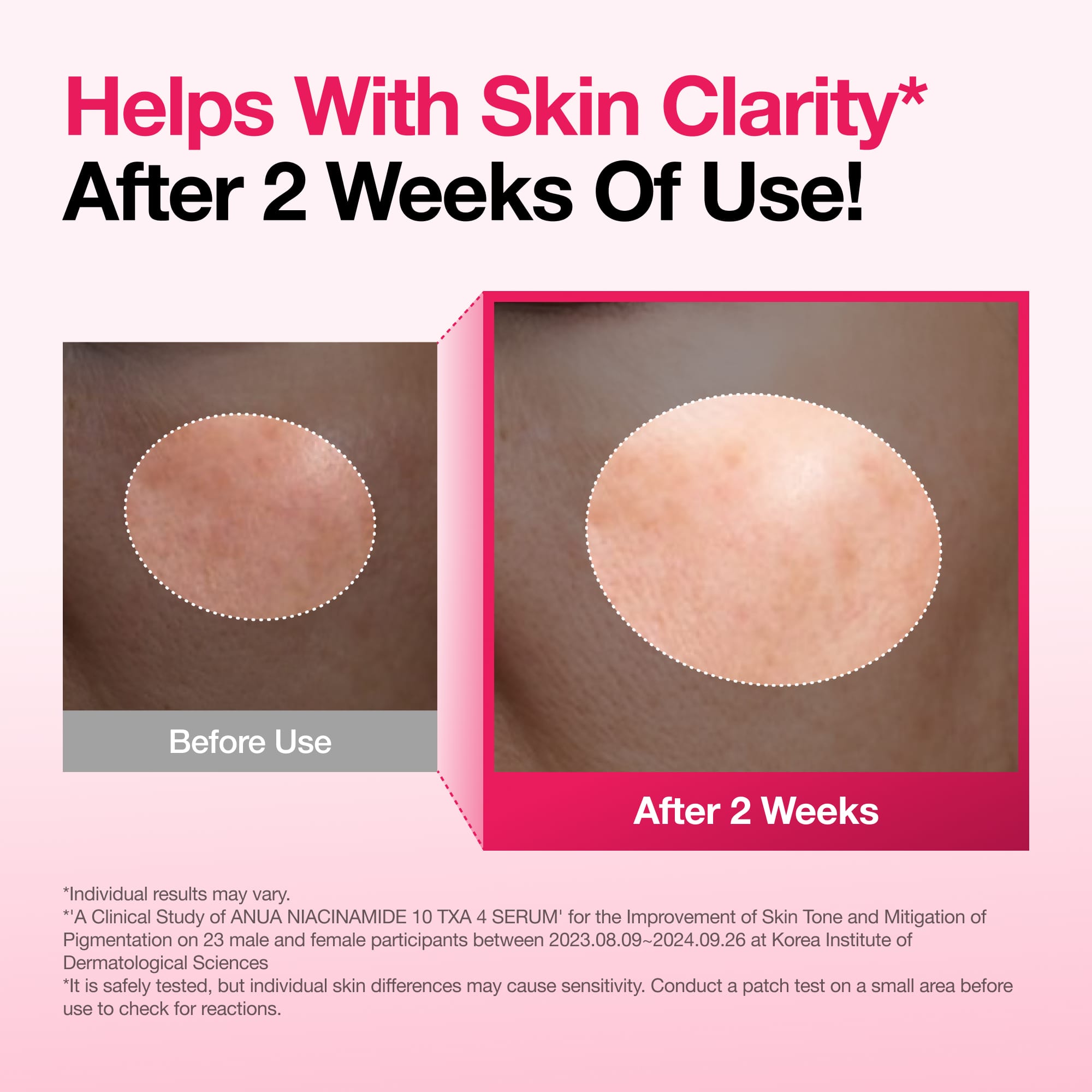 Niacinamide 10 TXA 4 Serum for Brightening and Dark Spots - Image 3