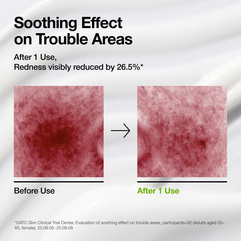 Azelaic Acid CICA Skin Soothing Moisturizer - Image 3