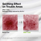 Azelaic Acid CICA Skin Soothing Moisturizer - Image 3