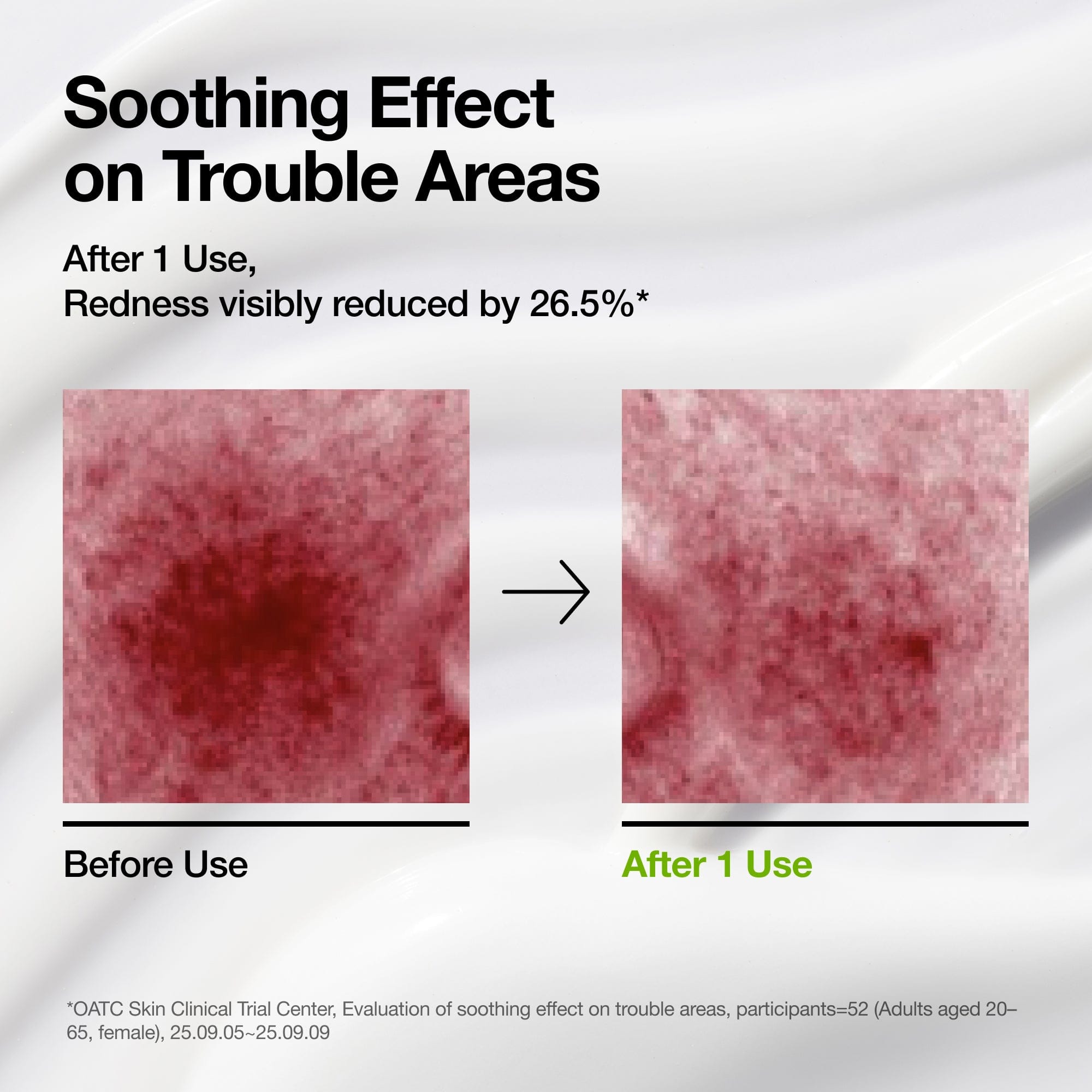 Azelaic Acid CICA Skin Soothing Moisturizer - Image 3