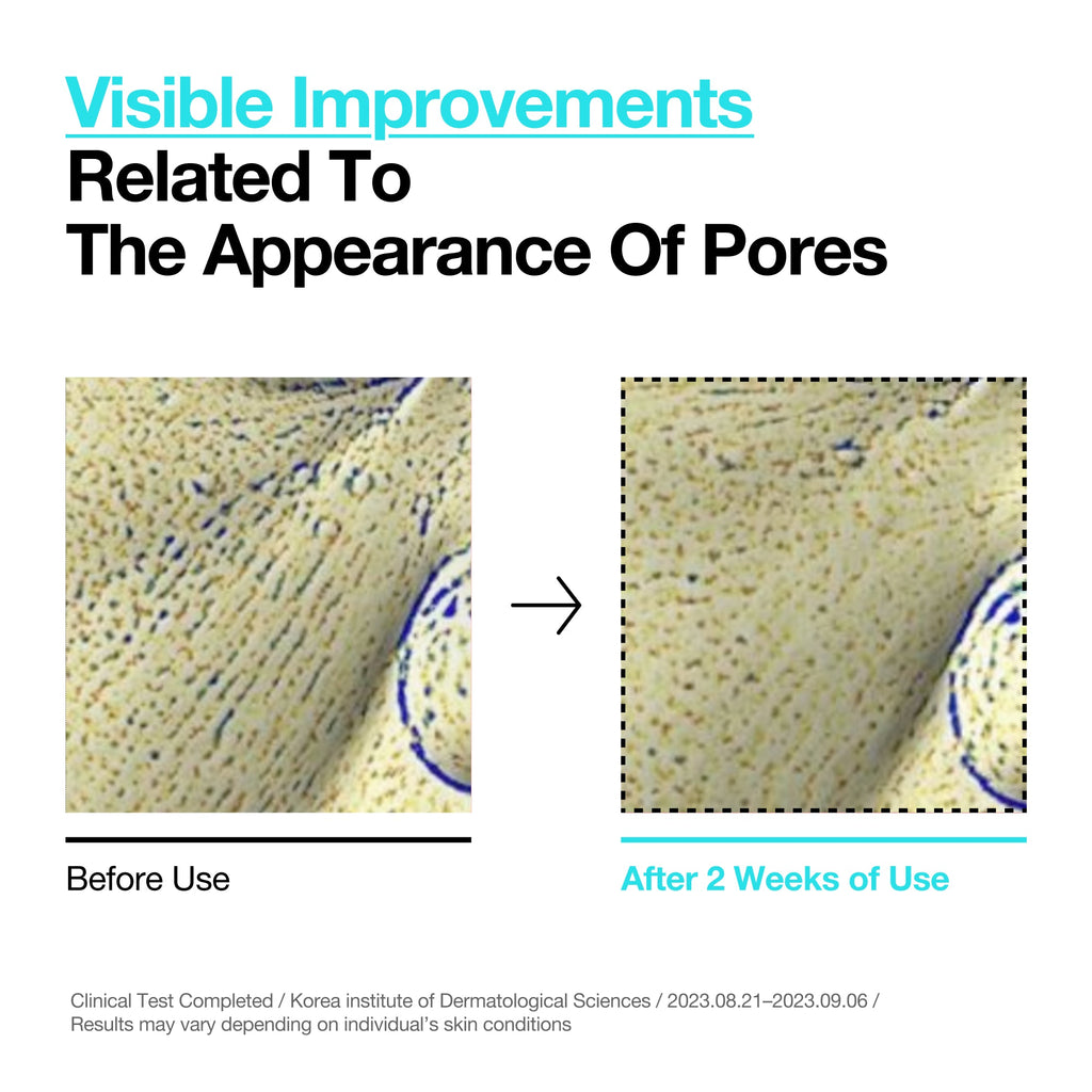 BHA 2% Gentle Exfoliating Toner - Image 3