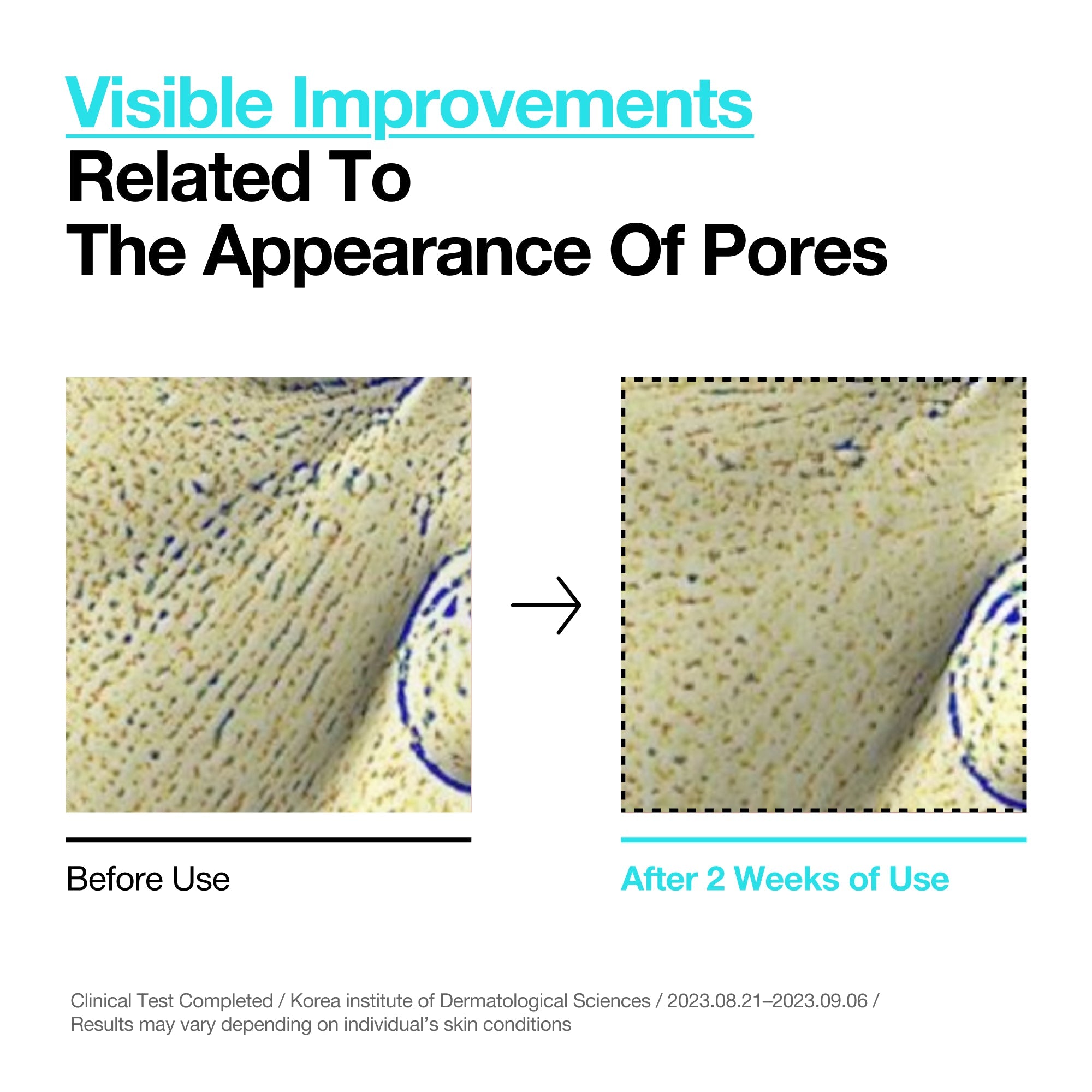 BHA 2% Gentle Exfoliating Toner - Image 3