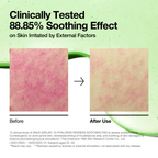 Azelaic 10 Hyaluron Redness Soothing Pad - Image 3