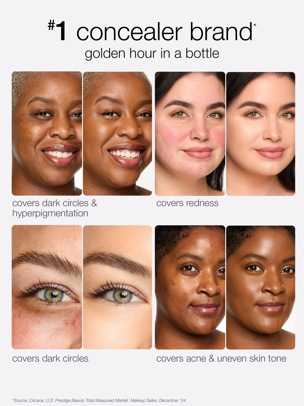 Advertisement for a concealer brand showing its effectiveness on various skin tones and issues.