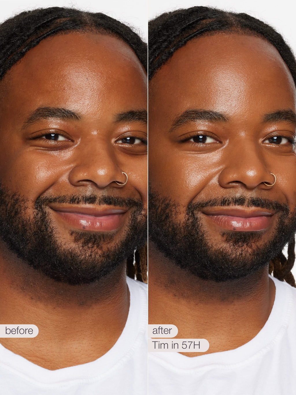 Before and after comparison of a man with facial hair, showing a visible change over time.