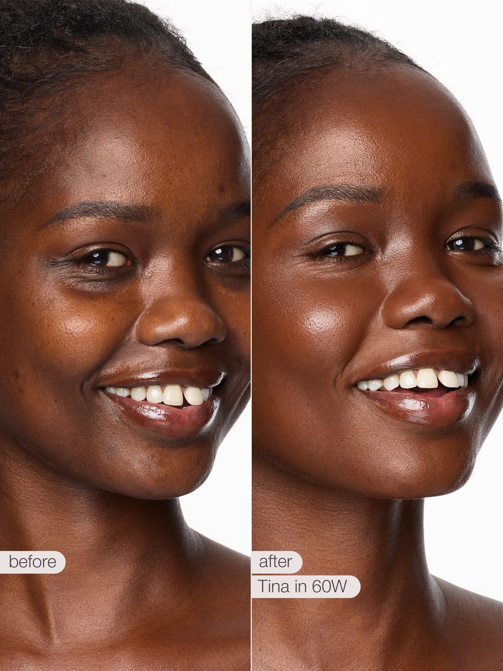 Before and after comparison of a woman's face with visible skin improvement.