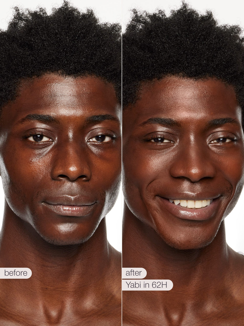 Before and after comparison of a man's face with 'Yabi in 62H' product application.