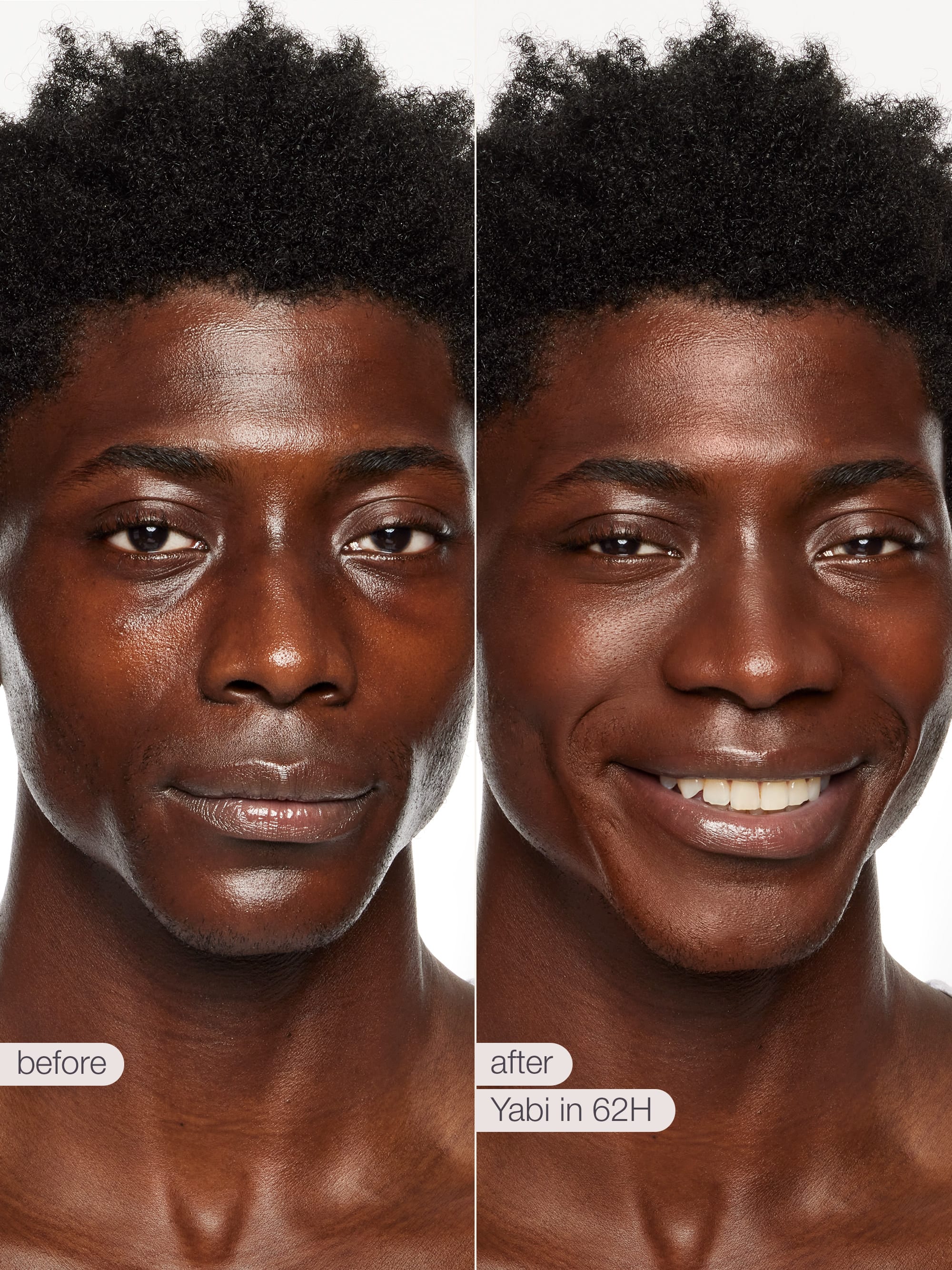 Before and after comparison of a man's face with 'Yabi in 62H' product application.