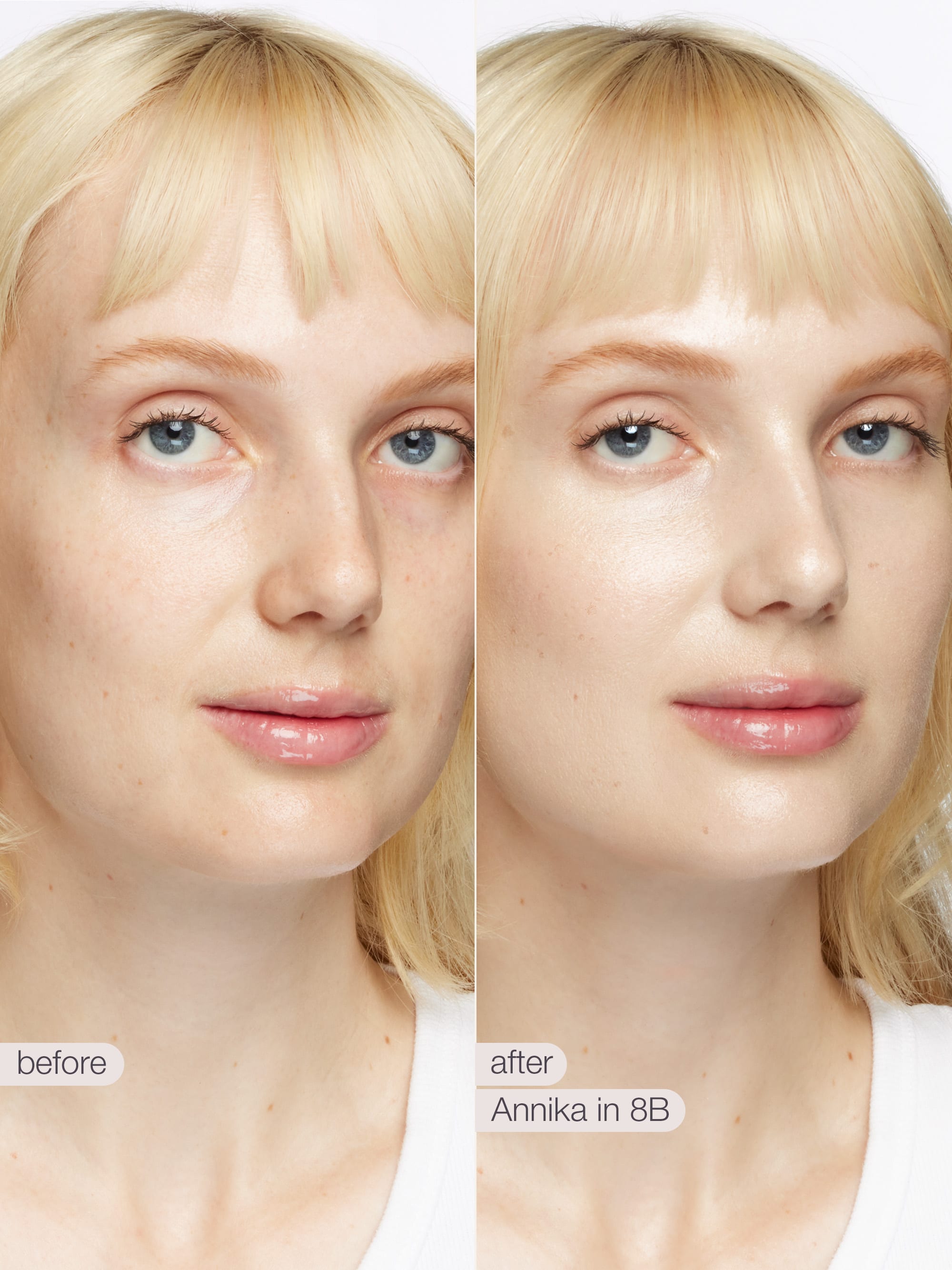 Before and after comparison of a woman's face with blonde hair, showing a cosmetic effect.