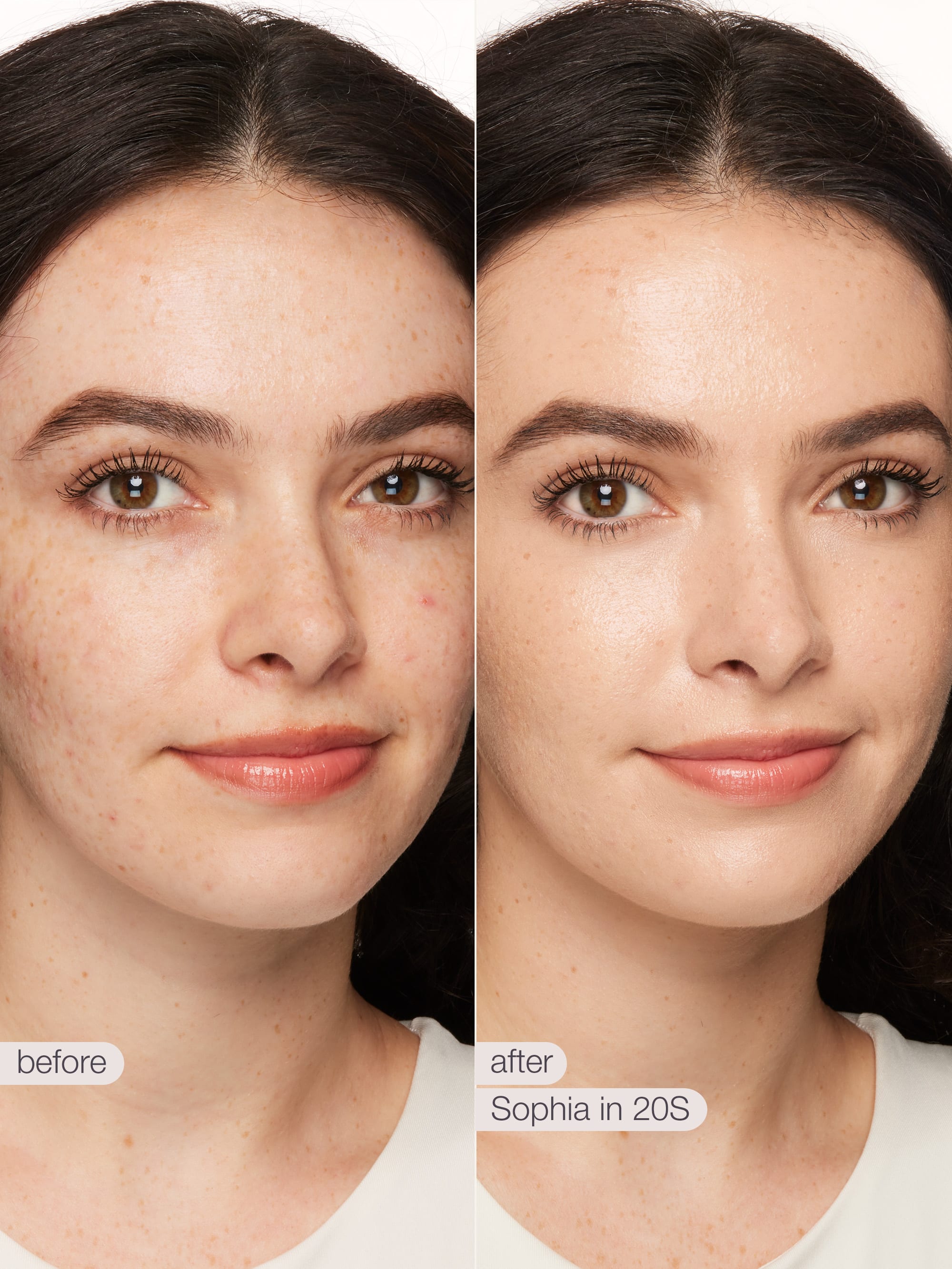 Before and after comparison of a woman's face with visible skin improvement.