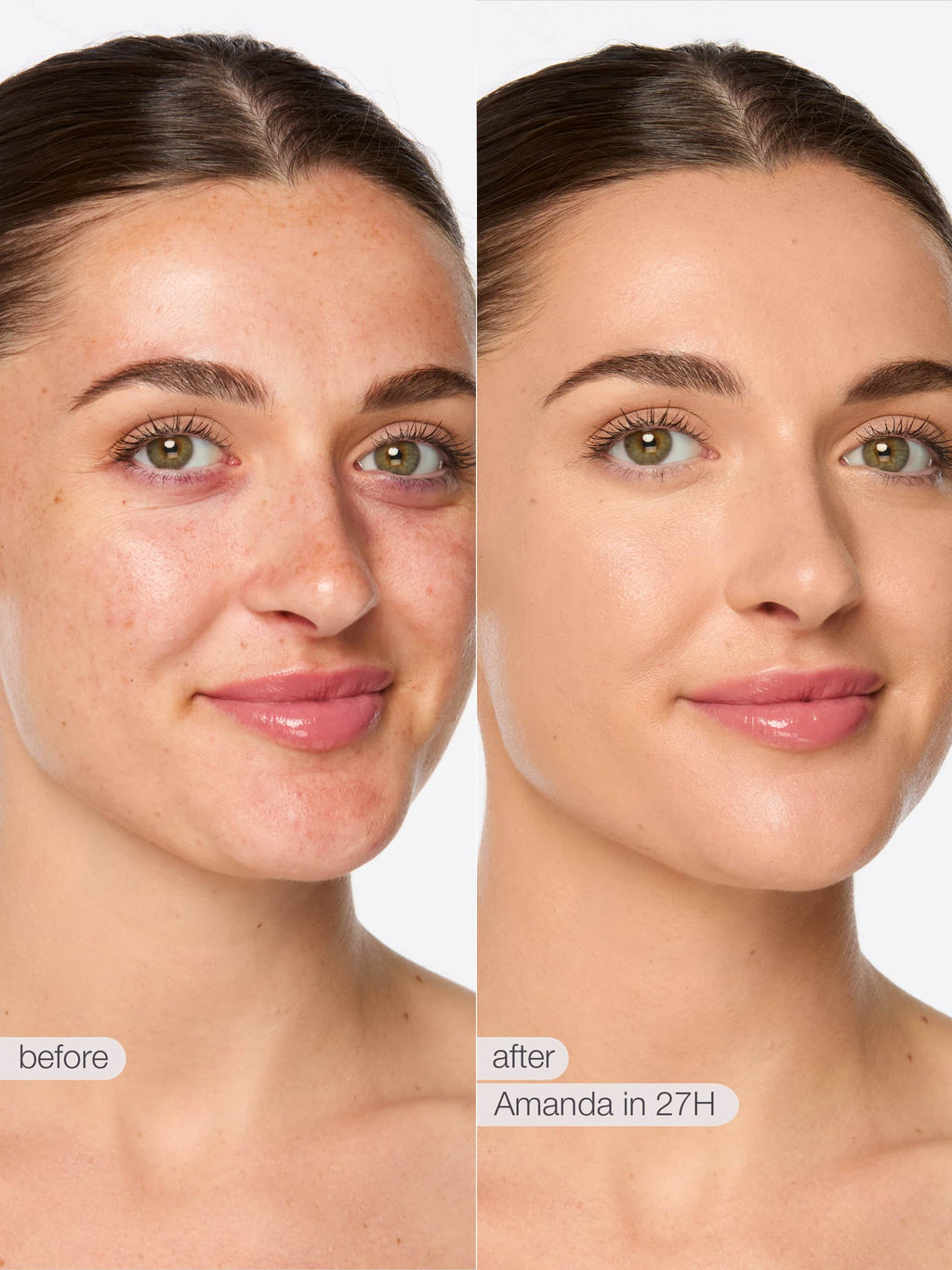 Before and after comparison of a woman's face with text indicating 'Amanda in 27H'.