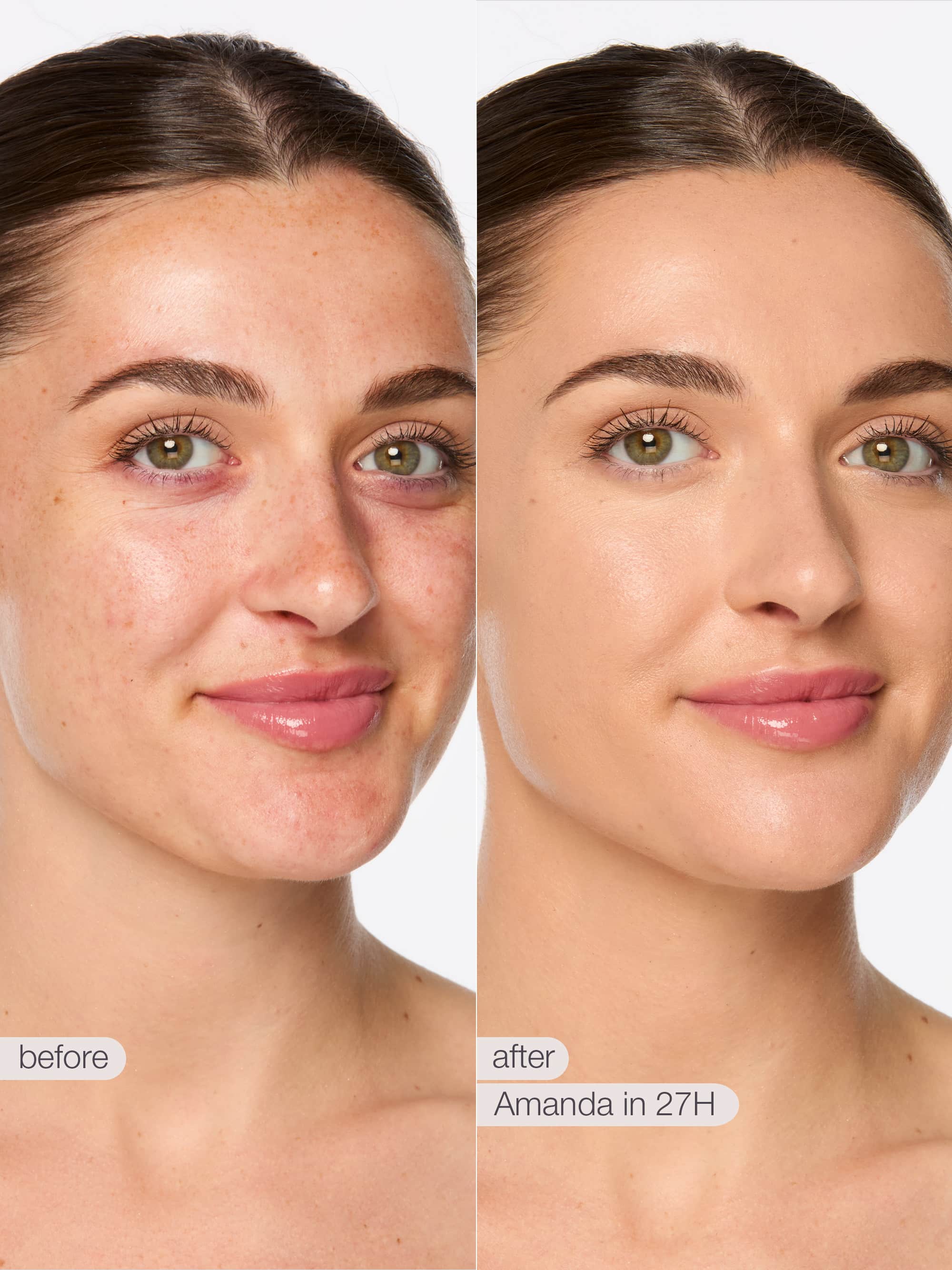 Before and after comparison of a woman's face with text indicating 'Amanda in 27H'.