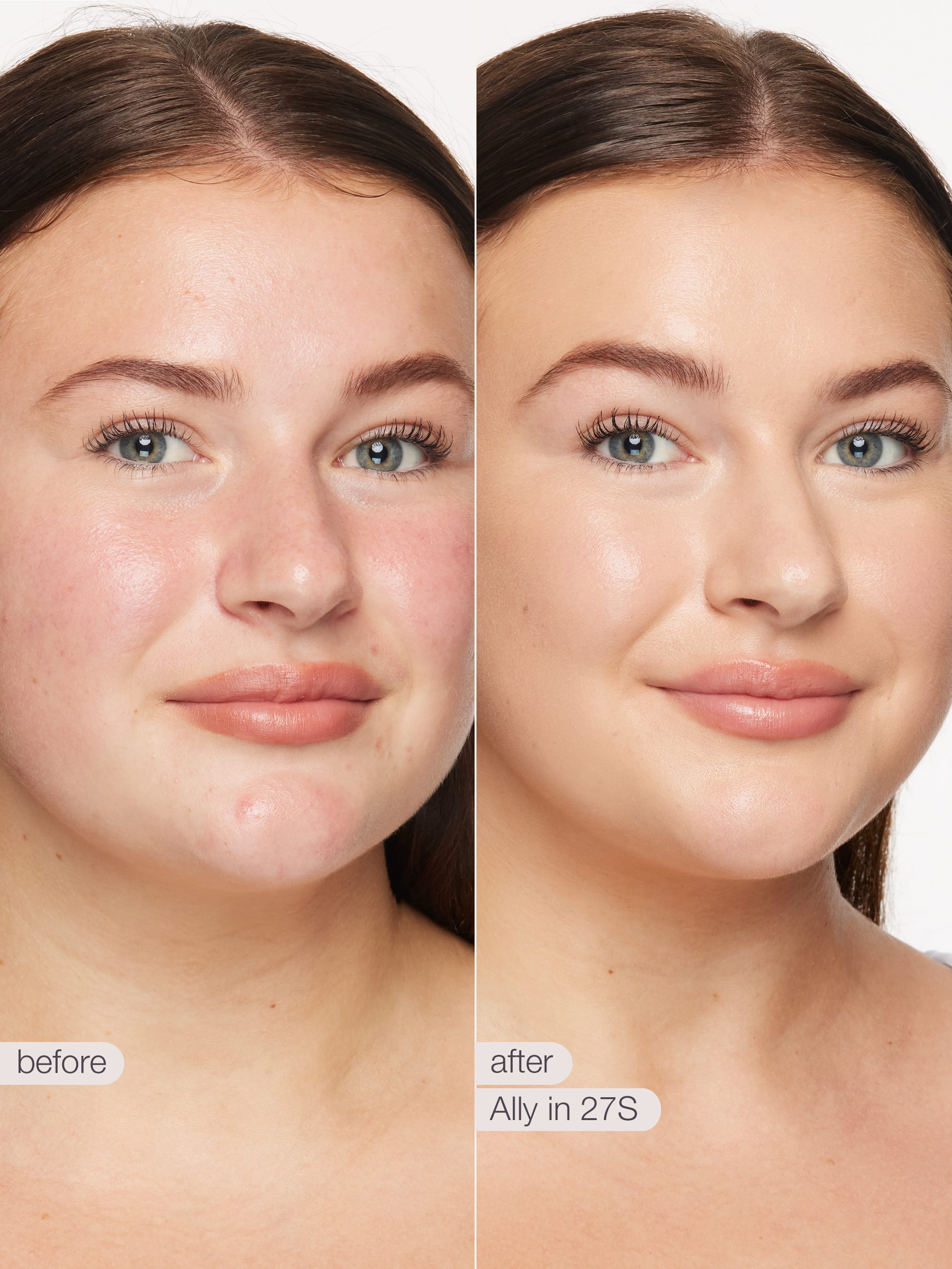 Before and after comparison of a woman's face with text indicating a skincare treatment.
