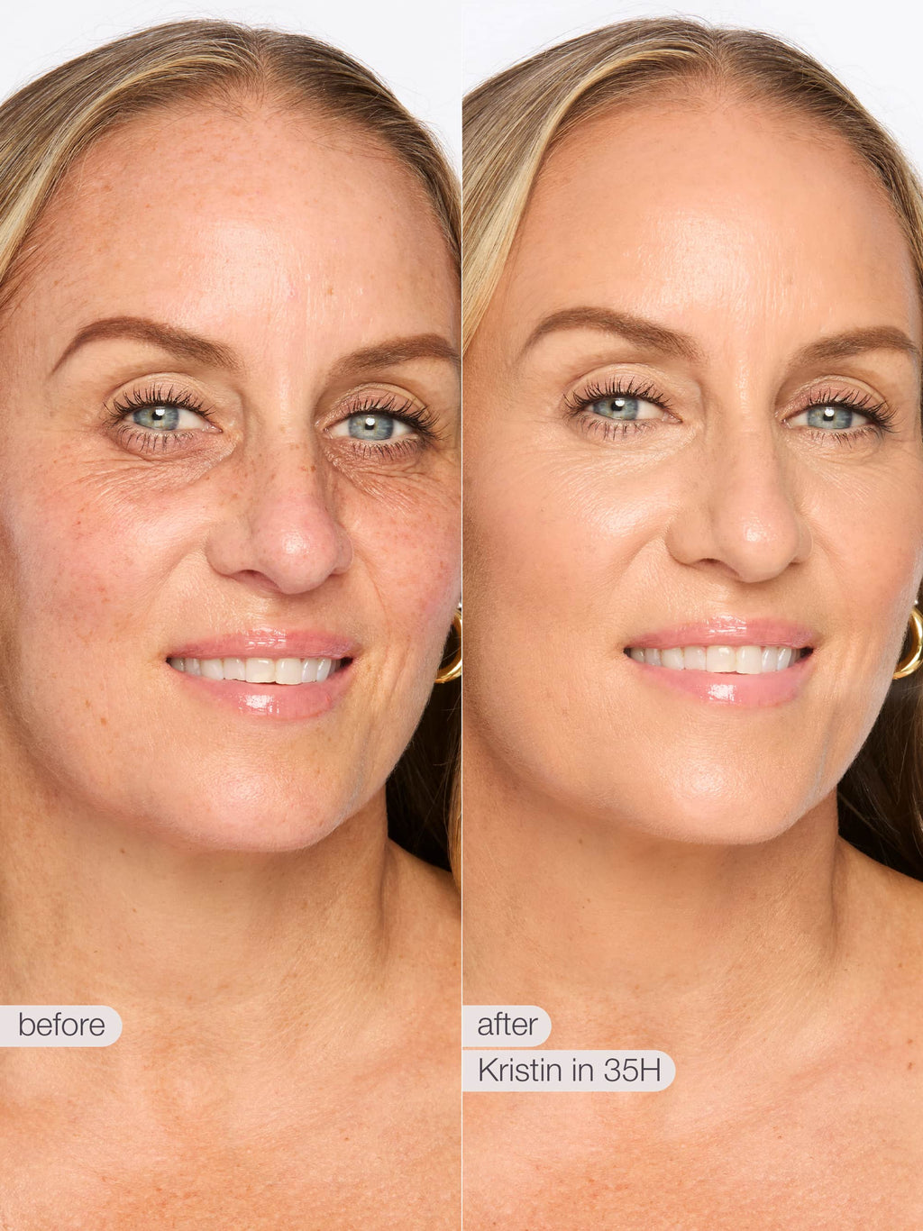 Before and after comparison of a woman's face with text indicating 'before' and 'after' with 'Kristin in 35H'.