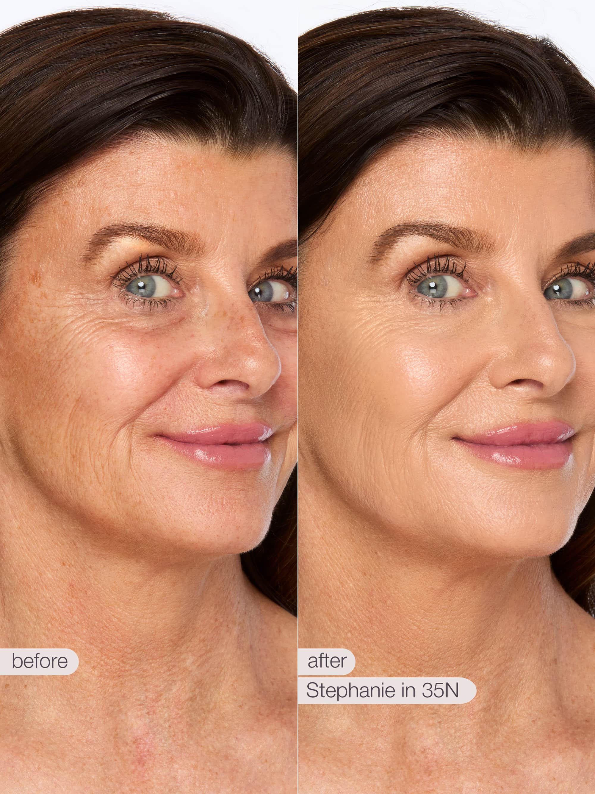 Before and after comparison of a woman's face with visible skin texture differences.