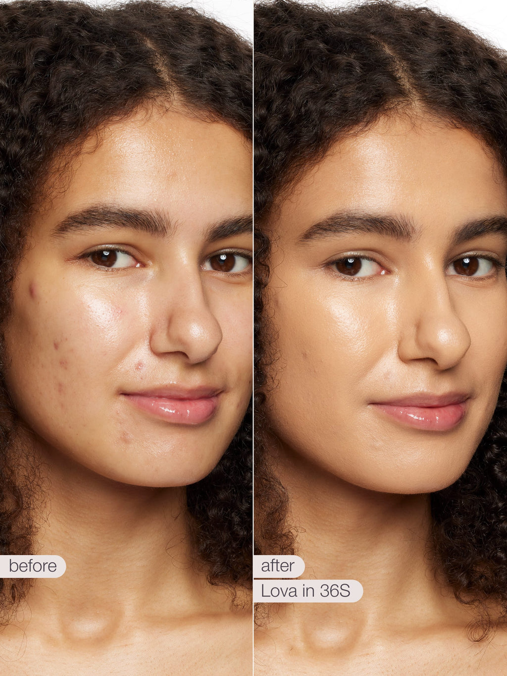 Before and after comparison of a woman's face with Lova skincare product application.