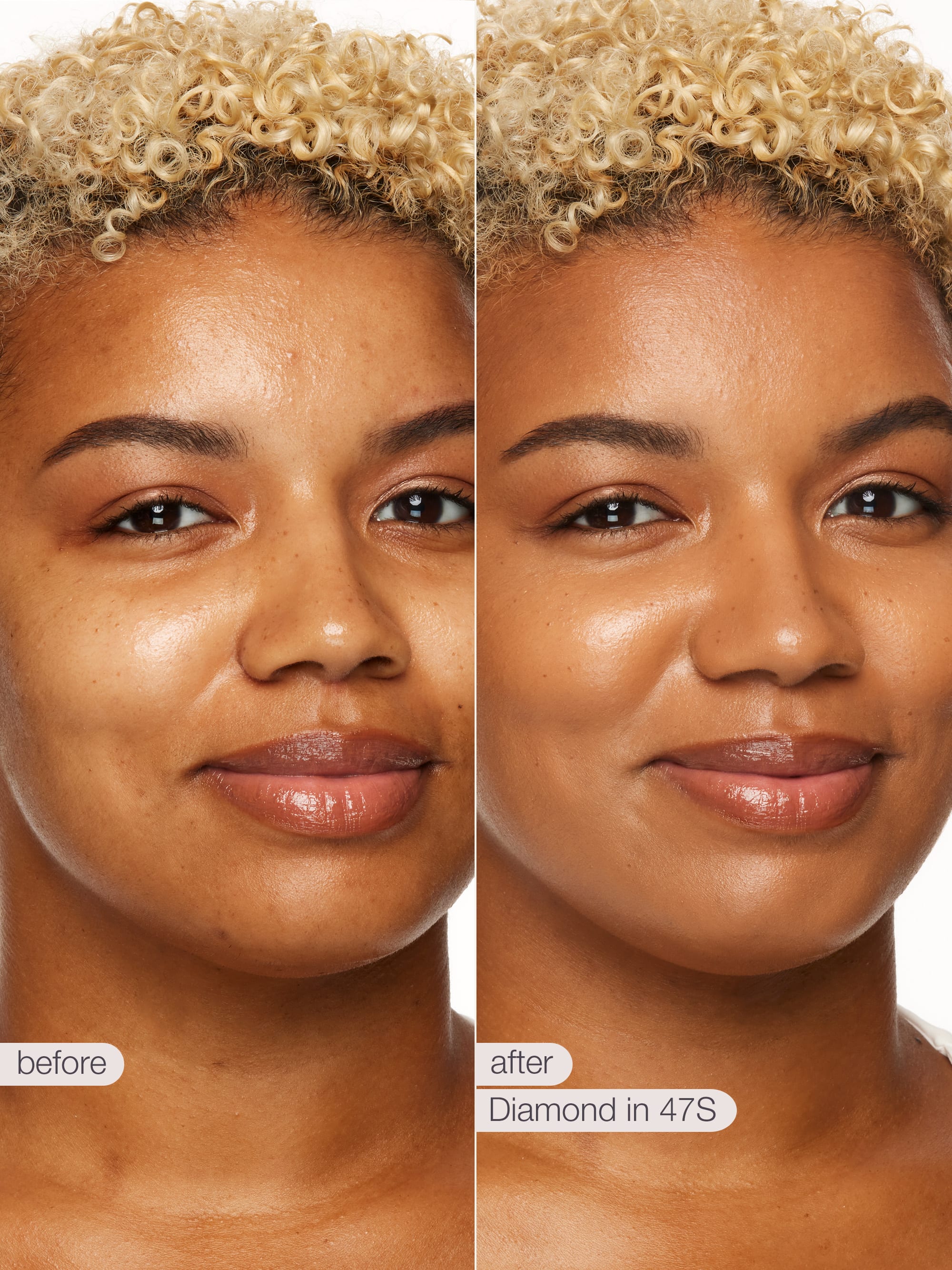 Before and after comparison of a woman's face with text indicating 'Diamond in 47S' treatment.