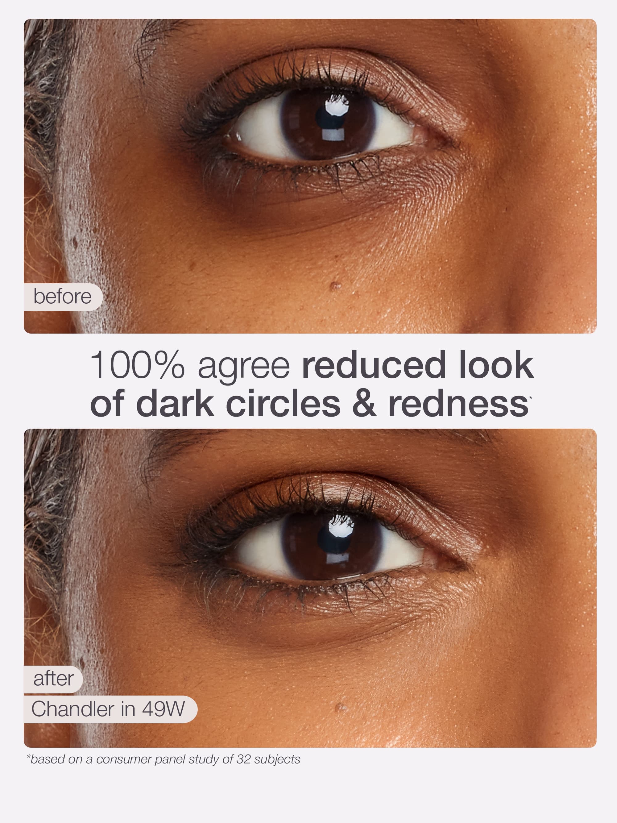 Before and after comparison of dark circles and redness reduction on a person's eye using Chandler in 49W.