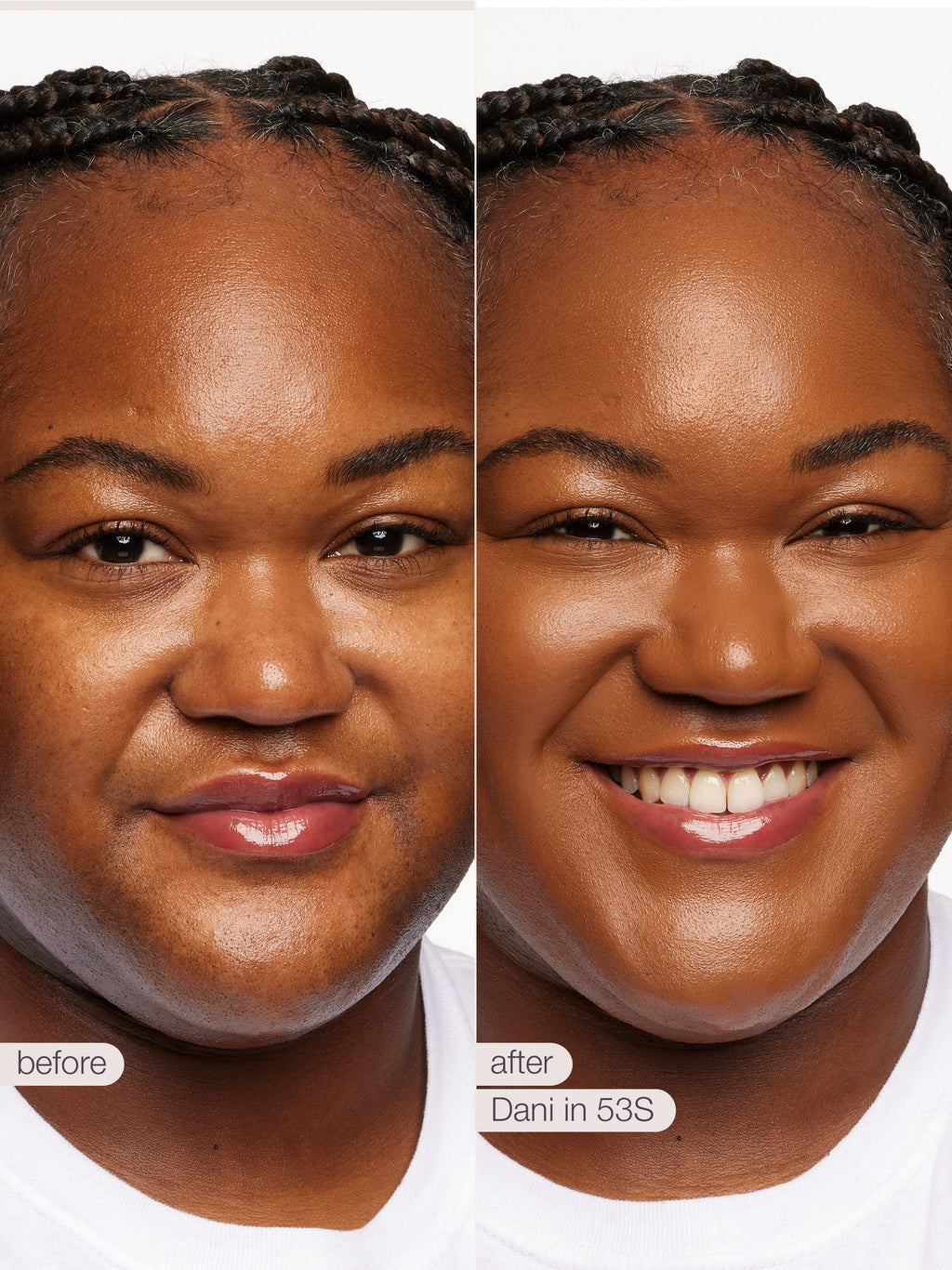 Before and after comparison of a woman's face with text indicating 'before' and 'after' and 'Dani in 53S'.