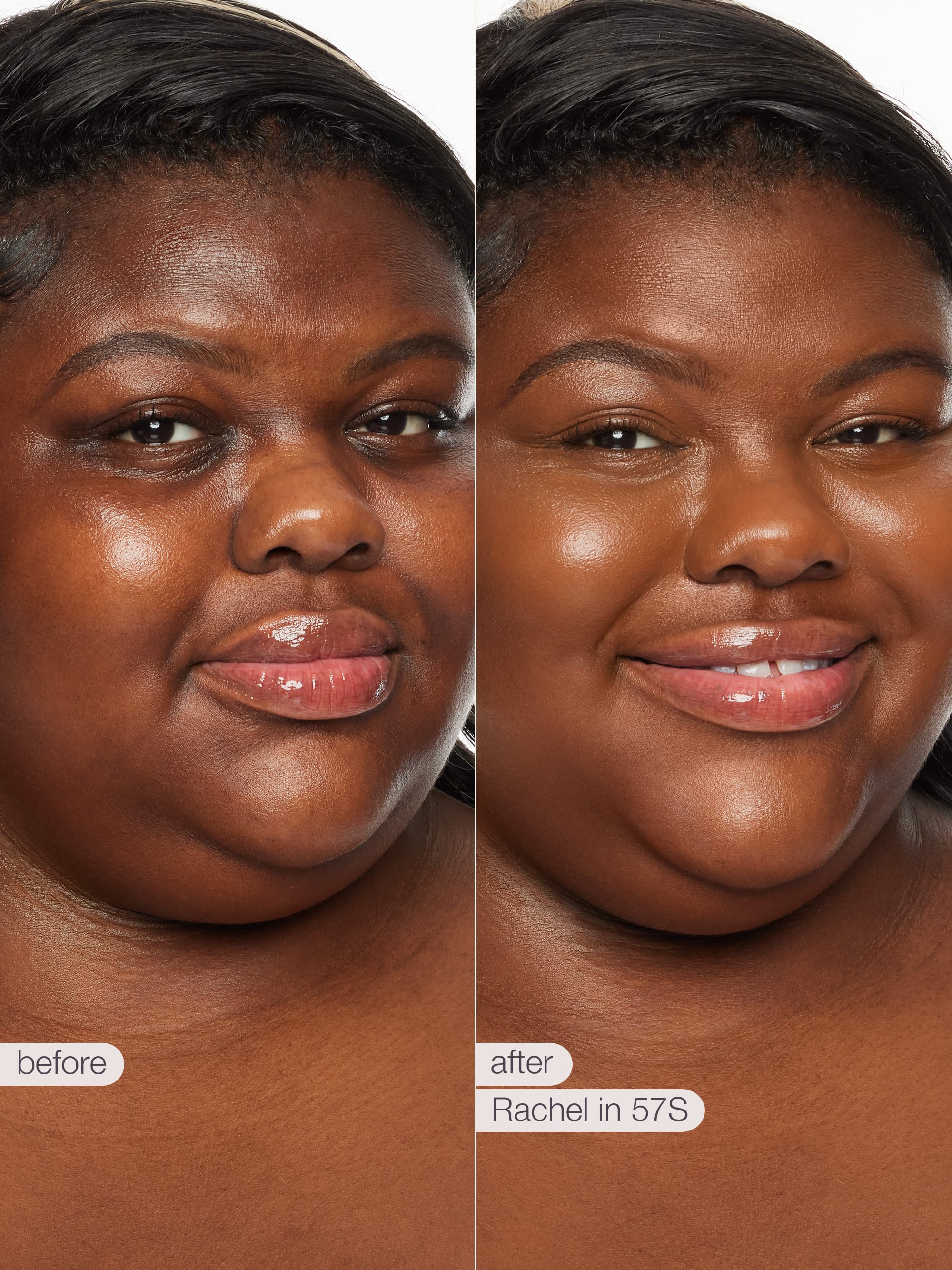 Before and after comparison of a woman's face with text labels 'before' and 'after'.