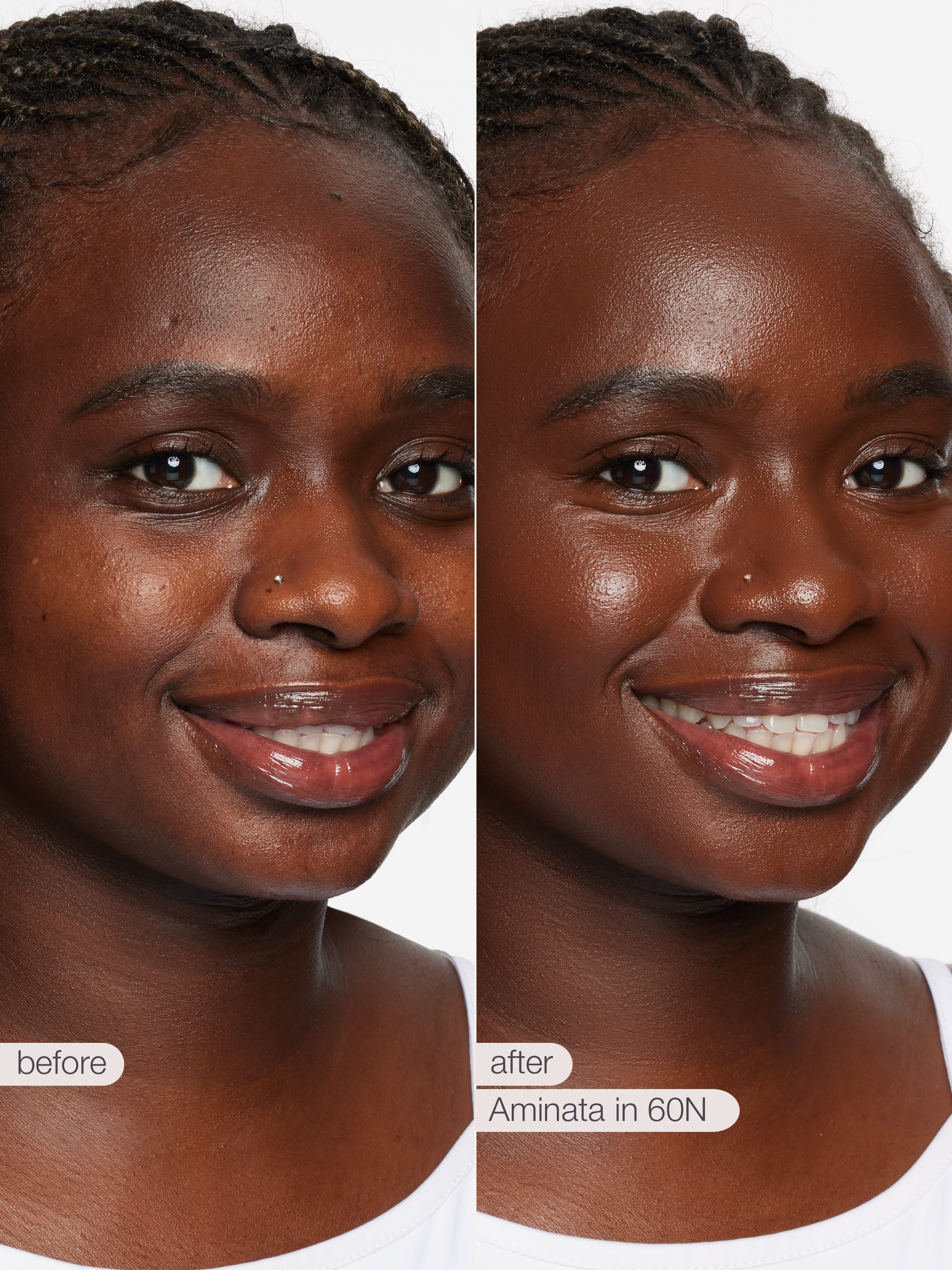 Before and after comparison of a woman's face with visible skin improvement using Aminata in 60N.
