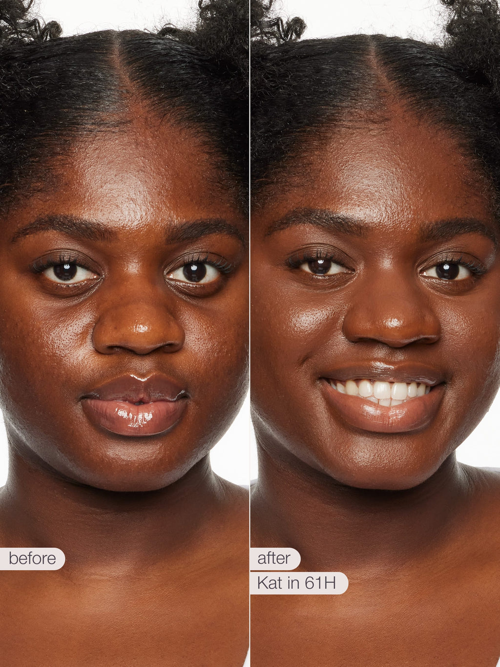 Before and after comparison of a woman's face with text indicating 'before' and 'after' on a white background.
